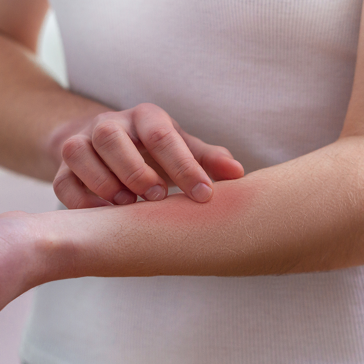 Persona con piel irritada en clínica de dermatología