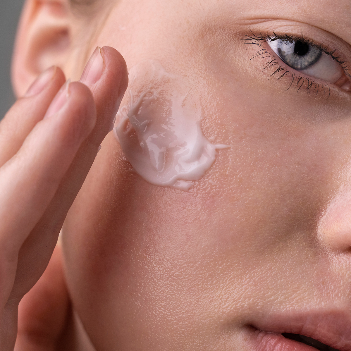 Chica aplicando tratamiento de dermatóloga para cuidad de la rosácea